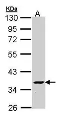 Anti-V-ATPase C2 antibody [N1C1] used in Western Blot (WB). GTX110740