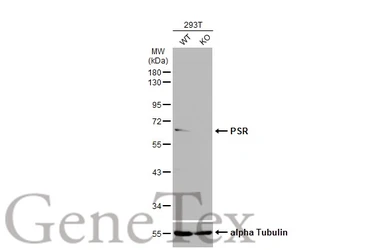 Anti-PSR antibody used in Western Blot (WB). GTX110746