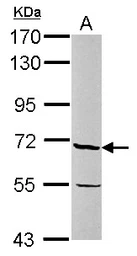 Anti-PSR antibody used in Western Blot (WB). GTX110746