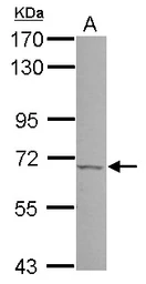 Anti-PSR antibody used in Western Blot (WB). GTX110746