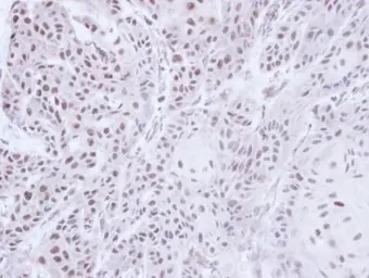 Anti-PSR antibody used in IHC (Paraffin sections) (IHC-P). GTX110746