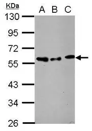 Anti-STAMBP antibody used in Western Blot (WB). GTX110754