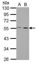 Anti-STAMBP antibody used in Western Blot (WB). GTX110754