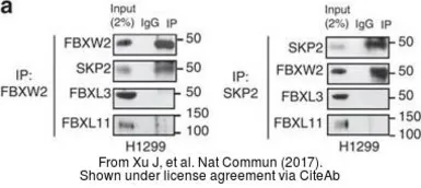 Anti-FBXL3 antibody used in Western Blot (WB). GTX110755