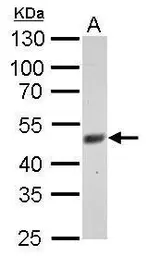 Anti-FBXL3 antibody used in Western Blot (WB). GTX110755