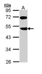Anti-FBXL3 antibody used in Western Blot (WB). GTX110755