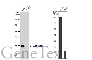 Anti-ATP6V1H antibody [N3C3] used in Western Blot (WB). GTX110778