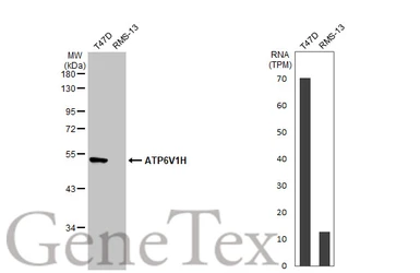 Anti-ATP6V1H antibody [N3C3] used in Western Blot (WB). GTX110778