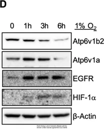 Anti-ATP6V1B2 antibody used in Western Blot (WB). GTX110783