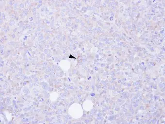 Anti-CARD9 antibody [N1N3] used in IHC (Paraffin sections) (IHC-P). GTX110789