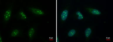 Anti-GTPBP4 antibody used in Immunocytochemistry/ Immunofluorescence (ICC/IF). GTX110825