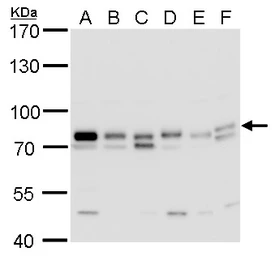 Anti-GTPBP4 antibody used in Western Blot (WB). GTX110825