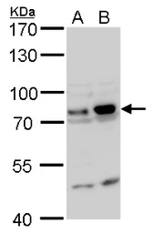 Anti-GTPBP4 antibody used in Western Blot (WB). GTX110825
