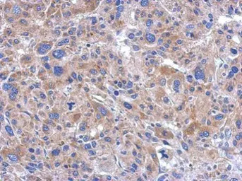 Anti-FASTKD5 antibody [C2C3], C-term used in IHC (Paraffin sections) (IHC-P). GTX110844