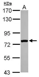 Anti-FASTKD5 antibody [C2C3], C-term used in Western Blot (WB). GTX110844