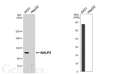 Anti-NALP2 antibody [N3C2], Internal used in Western Blot (WB). GTX110886