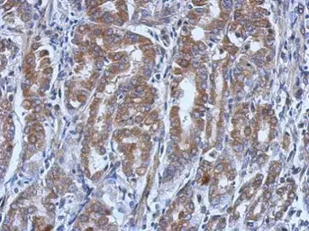 Anti-UBE4A antibody [N3C2], Internal used in IHC (Paraffin sections) (IHC-P). GTX110889