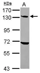 Anti-UBE4A antibody [N3C2], Internal used in Western Blot (WB). GTX110889
