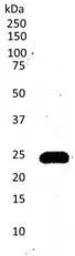 Anti-CD3 epsilon antibody [CD3-12] used in Western Blot (WB). GTX11089