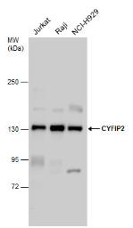 Anti-CYFIP2 antibody [N2C1], Internal used in Western Blot (WB). GTX110897