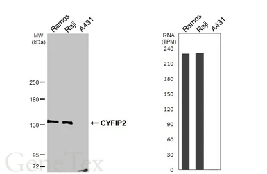 Anti-CYFIP2 antibody [N2C1], Internal used in Western Blot (WB). GTX110897