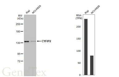 Anti-CYFIP2 antibody [N2C1], Internal used in Western Blot (WB). GTX110897