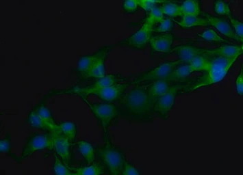 Anti-MYO6 antibody used in Immunocytochemistry/ Immunofluorescence (ICC/IF). GTX11096