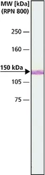 Anti-MYO6 antibody used in Western Blot (WB). GTX11096