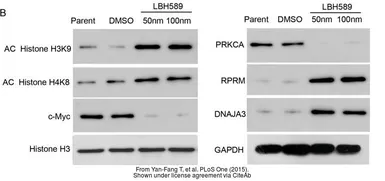 Anti-RPRM antibody [N1C3] used in Western Blot (WB). GTX110976