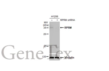 Anti-RPRM antibody [N1C3] used in Western Blot (WB). GTX110976