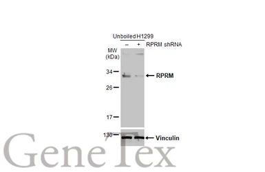 Anti-RPRM antibody [N1C3] used in Western Blot (WB). GTX110976