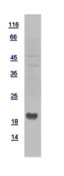 Human NDUFB6 protein, His tag. GTX110979-pro
