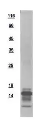 Human C8orf4 protein, His tag. GTX110984-pro
