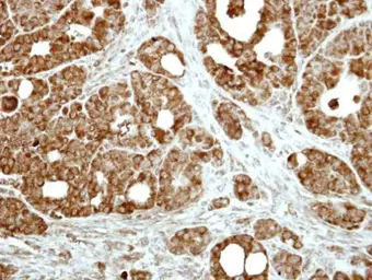 Anti-FAIM1 antibody [N1C3] used in IHC (Paraffin sections) (IHC-P). GTX110991