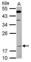 Anti-FAIM1 antibody [N1C3] used in Western Blot (WB). GTX110991