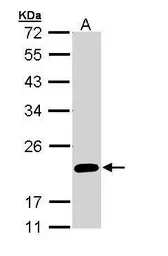 Anti-FAIM1 antibody [N1C3] used in Western Blot (WB). GTX110991
