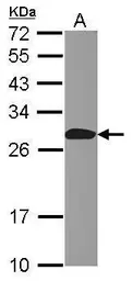 Anti-Apc10 antibody [N1C3] used in Western Blot (WB). GTX110993