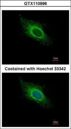 Anti-ATP5J antibody used in Immunocytochemistry/ Immunofluorescence (ICC/IF). GTX110996