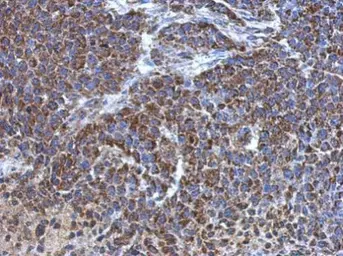 Anti-ATP5J antibody used in IHC (Paraffin sections) (IHC-P). GTX110996