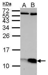 Anti-ATP5J antibody used in Western Blot (WB). GTX110996
