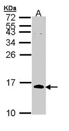 Anti-CDC26 antibody [N1C3] used in Western Blot (WB). GTX111007