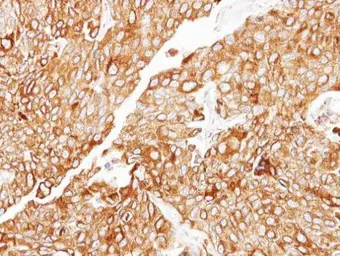 Anti-CIDEC antibody [N1C3] used in IHC (Paraffin sections) (IHC-P). GTX111008