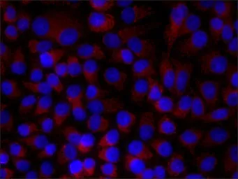Anti-Paxillin antibody [PXC-10] used in Immunocytochemistry/ Immunofluorescence (ICC/IF). GTX11101