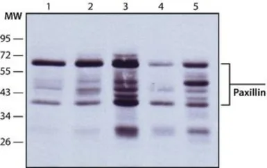Anti-Paxillin antibody [PXC-10] used in Western Blot (WB). GTX11101