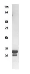 Human FIS1 protein, His tag. GTX111010-pro
