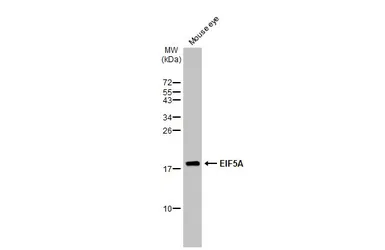 Anti-EIF5A antibody used in Western Blot (WB). GTX111013