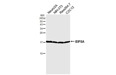 Anti-EIF5A antibody used in Western Blot (WB). GTX111013