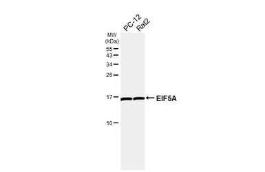 Anti-EIF5A antibody used in Western Blot (WB). GTX111013