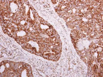 Anti-NDUFA5 antibody [N1C3] used in IHC (Paraffin sections) (IHC-P). GTX111016