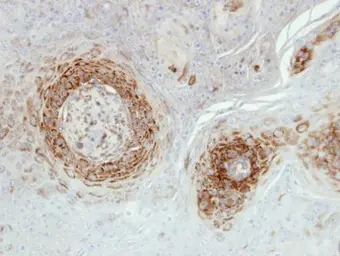 Anti-NDUFA5 antibody [N1C3] used in IHC (Paraffin sections) (IHC-P). GTX111016